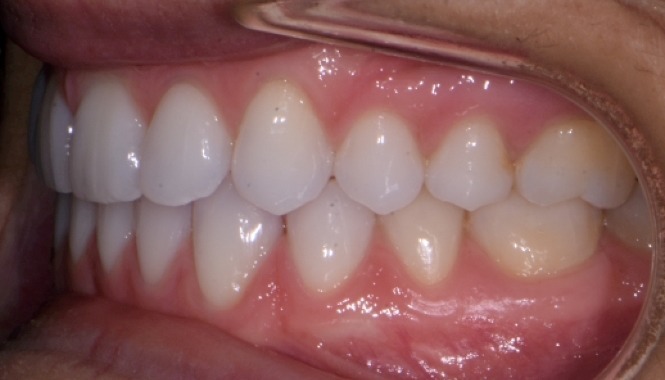 photo of smile